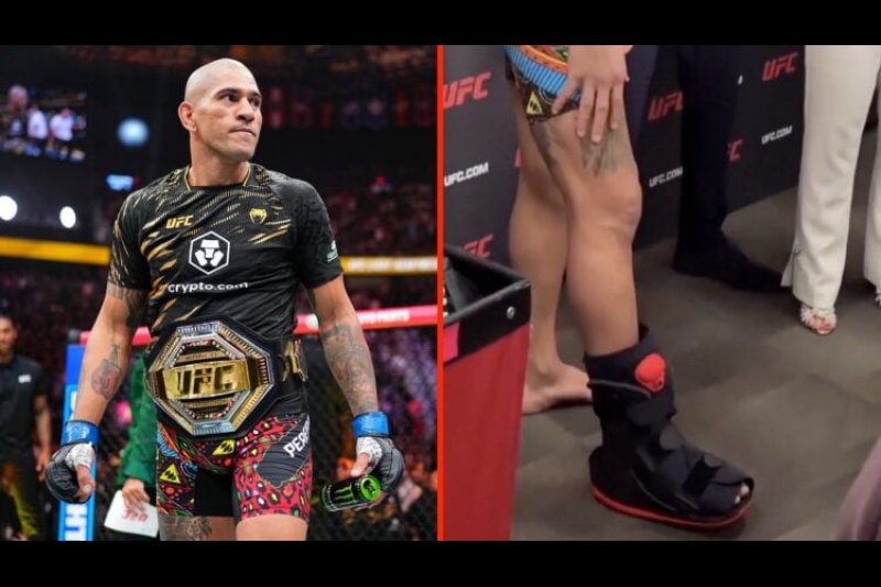 Alex Pereira Cuts the Boot, Pushes Back on Medical Orders After Foot Fracture - UFC Article