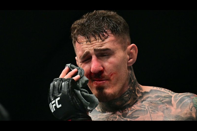 Aspinall’s Eye Injury Update: Champion Still Struggling to See After No-Contest Ending