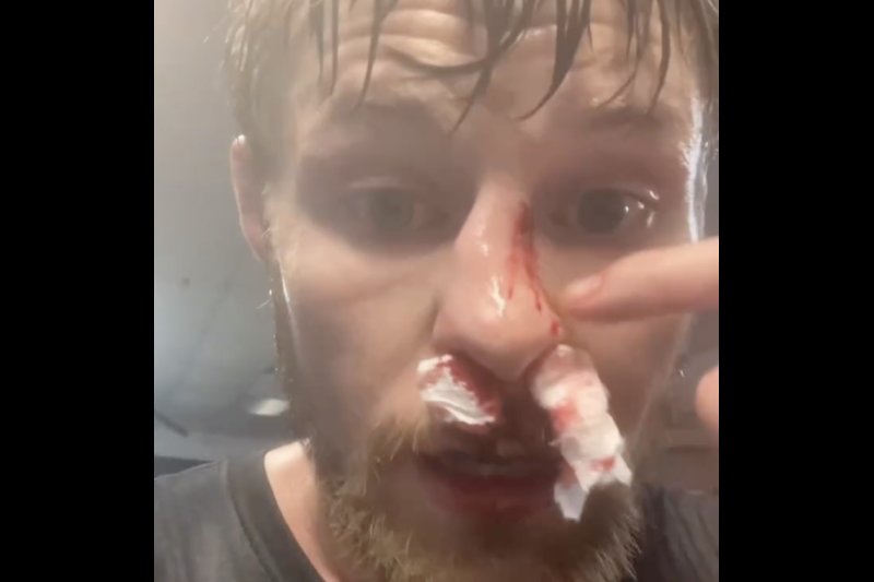 Thug Nasty” Signals Costly Reality After Nose Break: “Doctors Are Expensive" - UFC Article