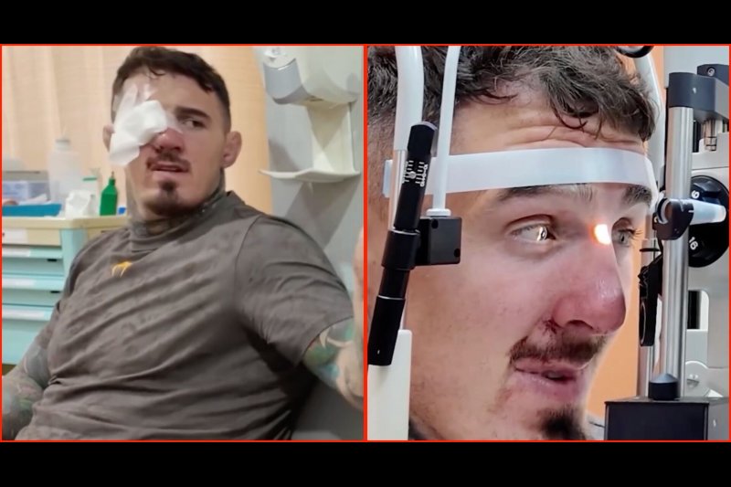 Tom Aspinall Breaks His Silence After UFC 321 No-Contest: “All That Training for That” - UFC Article