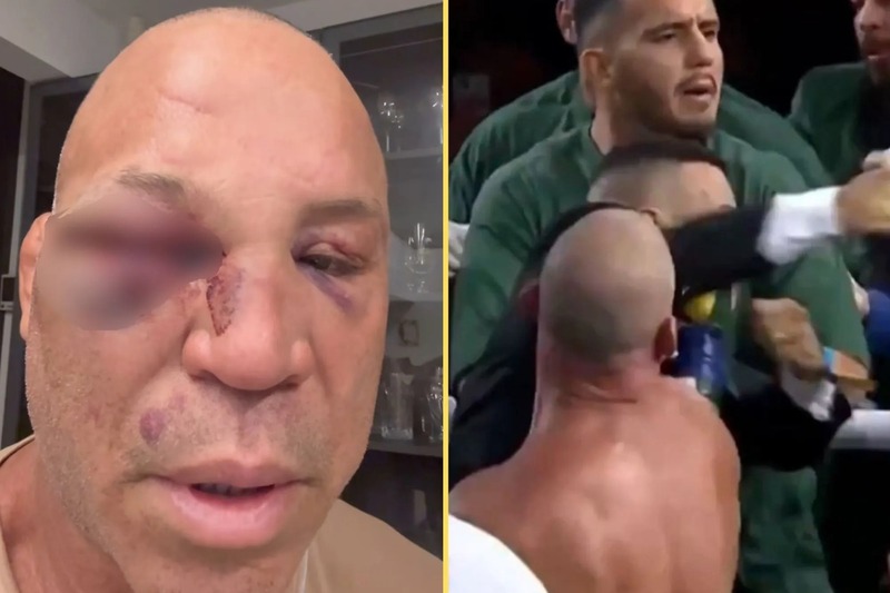 Wanderlei Silva Hospitalized After Brutal Knockout in Post-Fight Brawl - MMA News Article