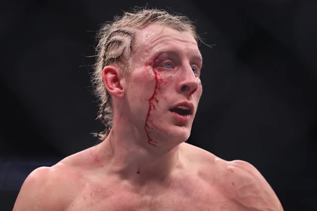 Paddy Pimblett's Crossroads: Liverpool Star Reflects on UFC Defeat and Maps Path Back to Title Contention